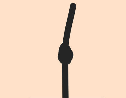 knot