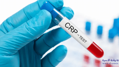 ماذا يدل ارتفاع تحليل CRP