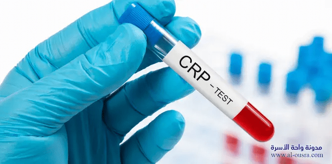 ماذا يدل ارتفاع تحليل CRP