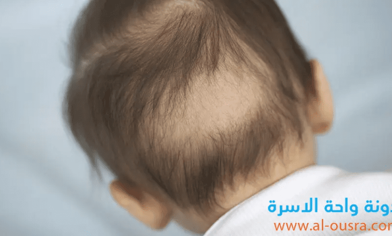 ما هي اسباب تساقط الشعر عند الاطفال ؟ وكيف يمكن علاجها ؟