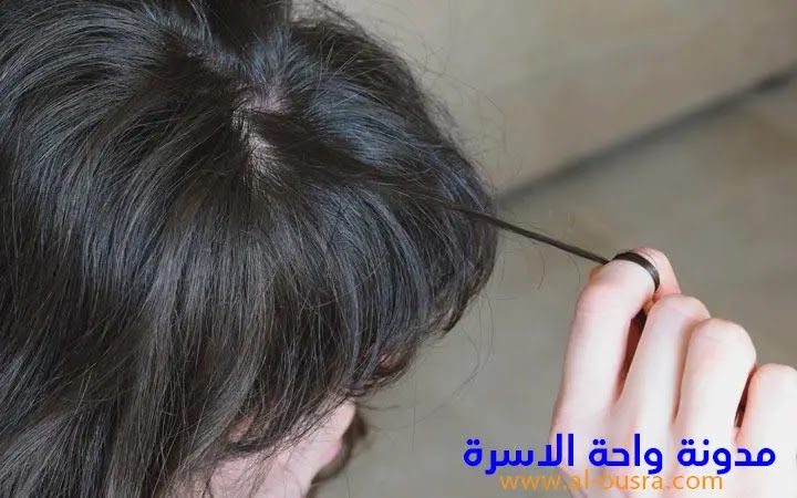 اسباب تساقط الشعر عند الاطفال