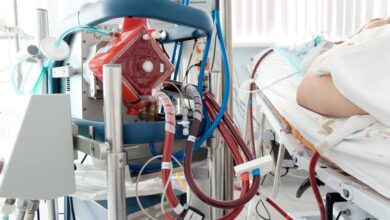 4 حالات تحتاج لوضع جهاز التهوية الميكانيكية