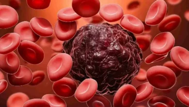 اورام السرطان